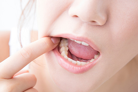 歯ぎしり・食いしばりが強い奥歯にも使用できる