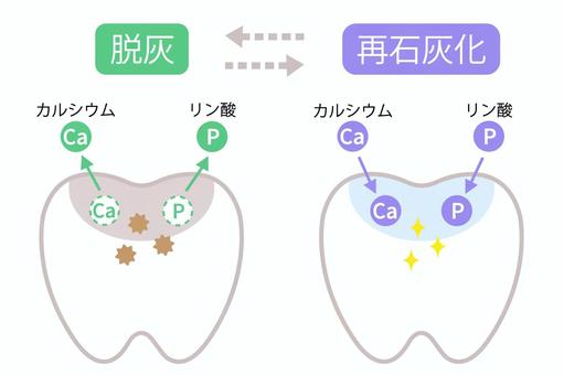 歯の再石灰化について