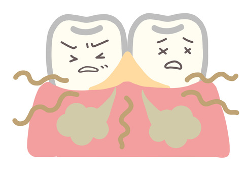歯垢とは