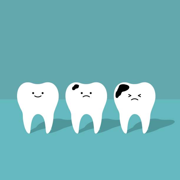 虫歯の原因について