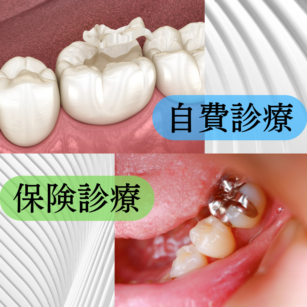 自費診療と保険診療の違い。