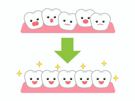 かみ合わせについて①