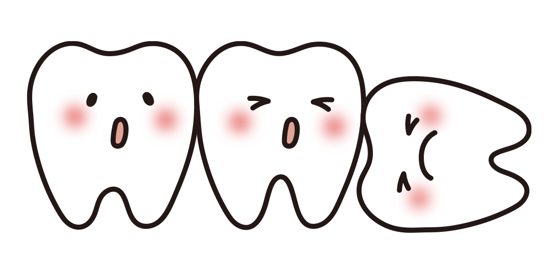 かみ合わせについて②